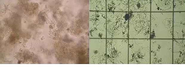 ��(y��u)�|(zh��)�����V�ϏS����ˮ̎��ָʾ��΢�����ȫ!����������