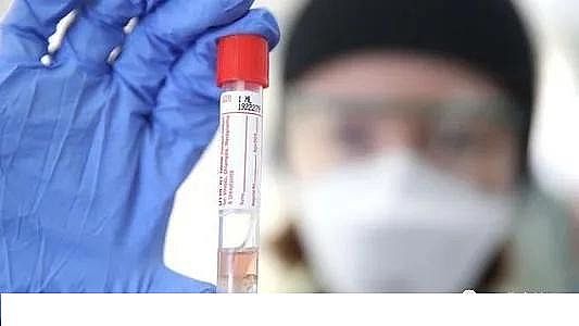 ú�|(zh��)�w������̿0.5-1mm�S�ҰĴ������о��ˆT�_�l(f��)���z�y��ˮ��Covid-19�����ϵ�y(t��ng)